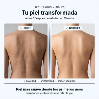 Toalla exfoliante de ducha Venasta